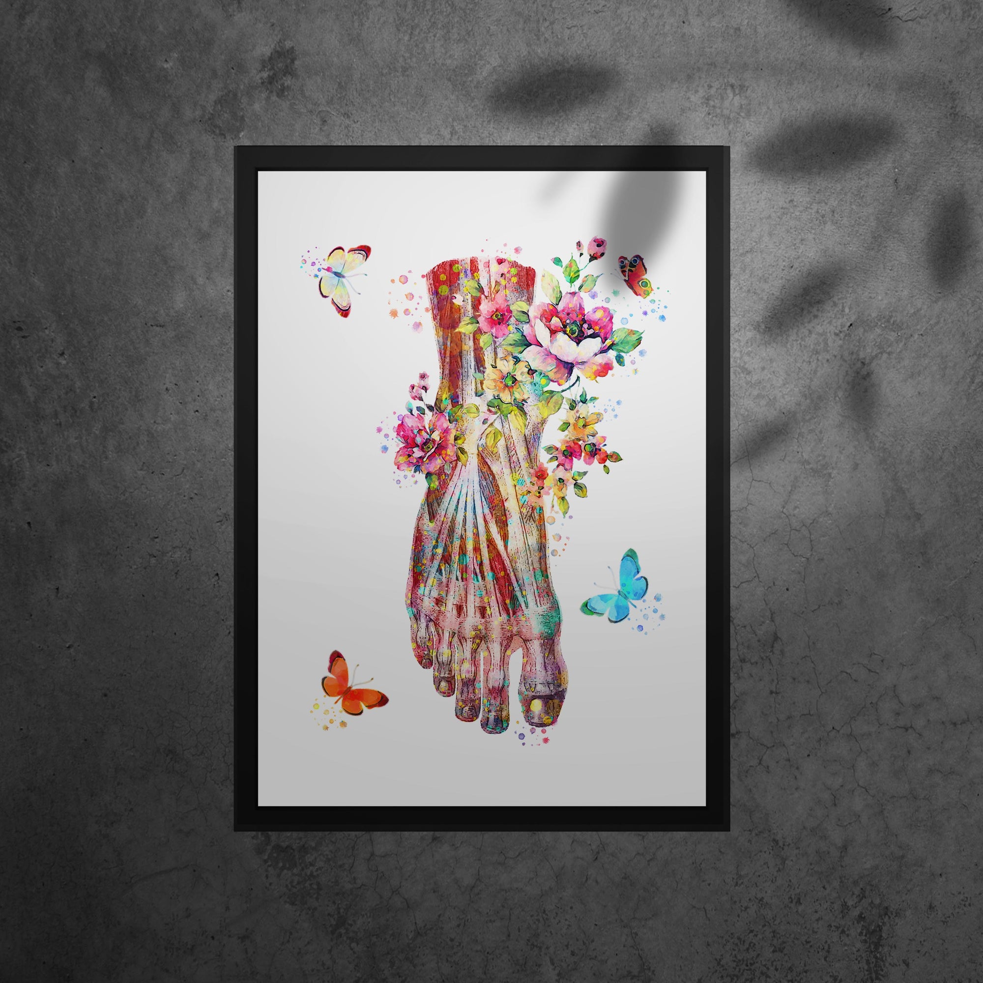 Muscular System Art - Framed Posters For Physiotherapist Clinics, Hospitals &amp; Study Rooms