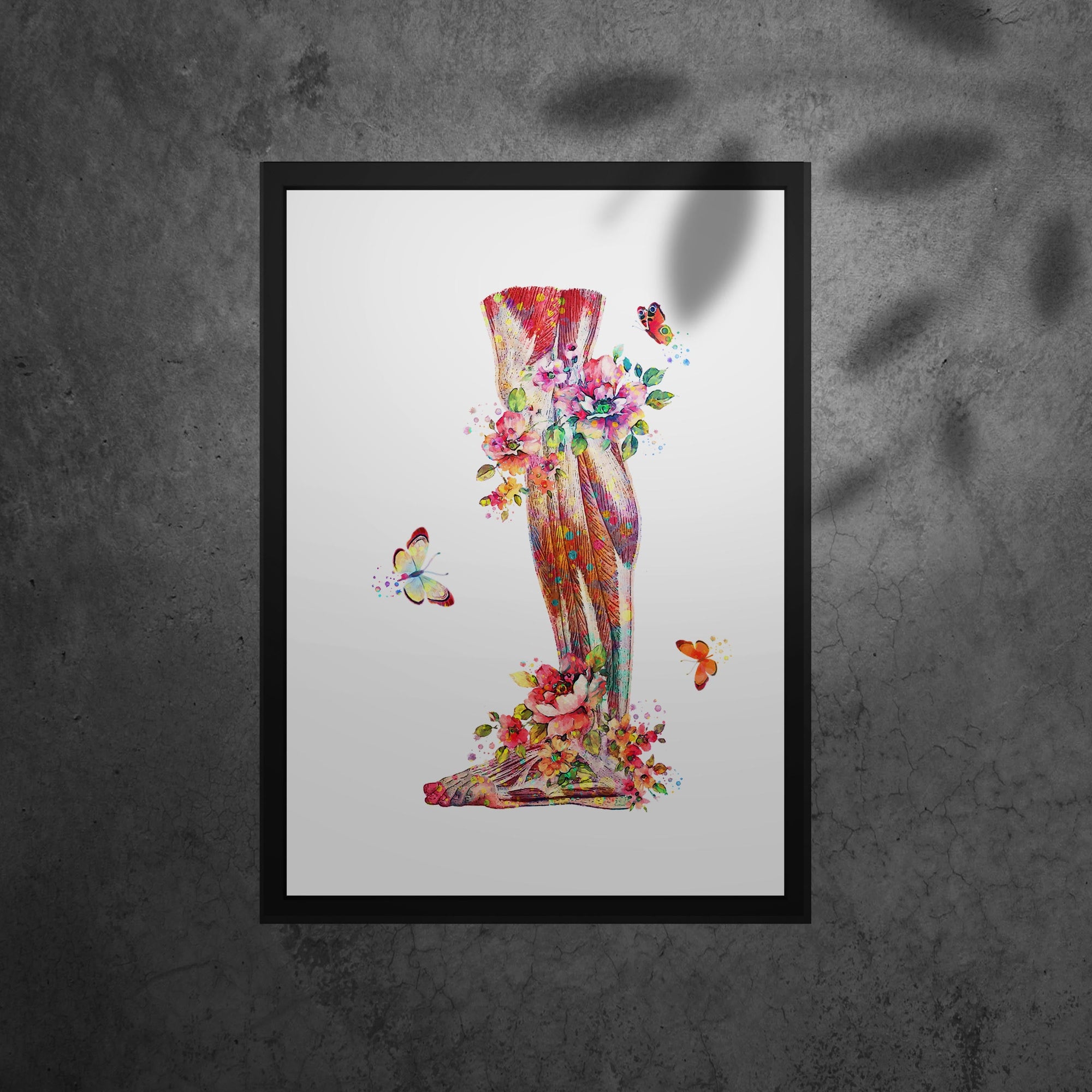 Muscular System Art - Framed Posters For Physiotherapist Clinics, Hospitals &amp; Study Rooms