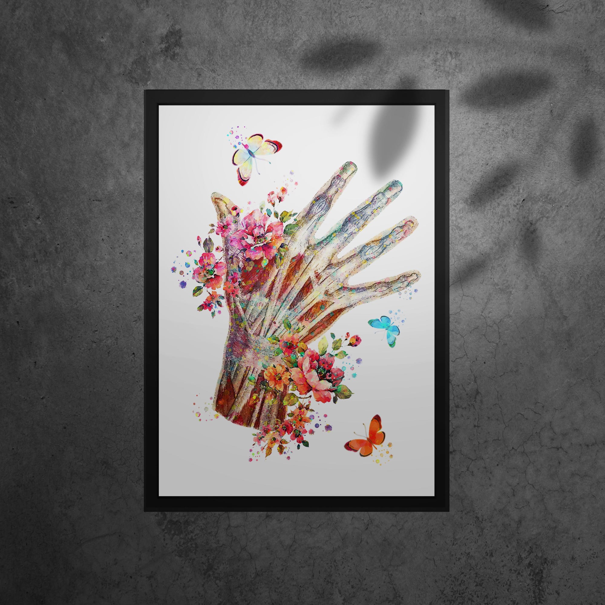 Muscular System Art - Framed Posters For Physiotherapist Clinics, Hospitals &amp; Study Rooms