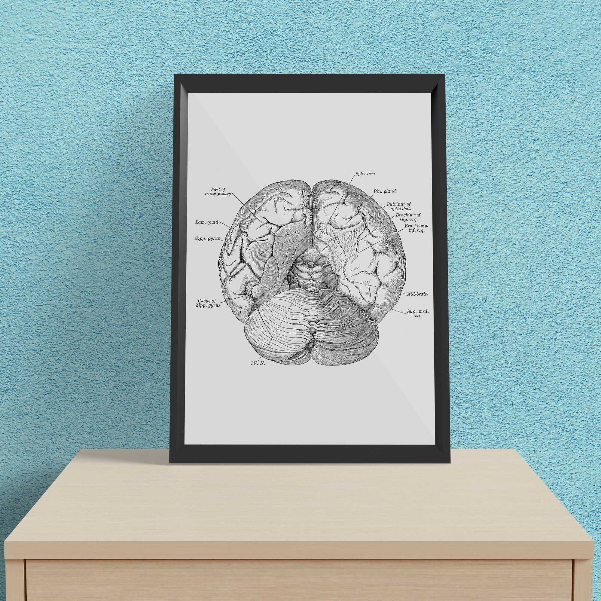 Antique Human Brain 1 - Framed Poster For Clinics, Hospitals &amp; Study Rooms