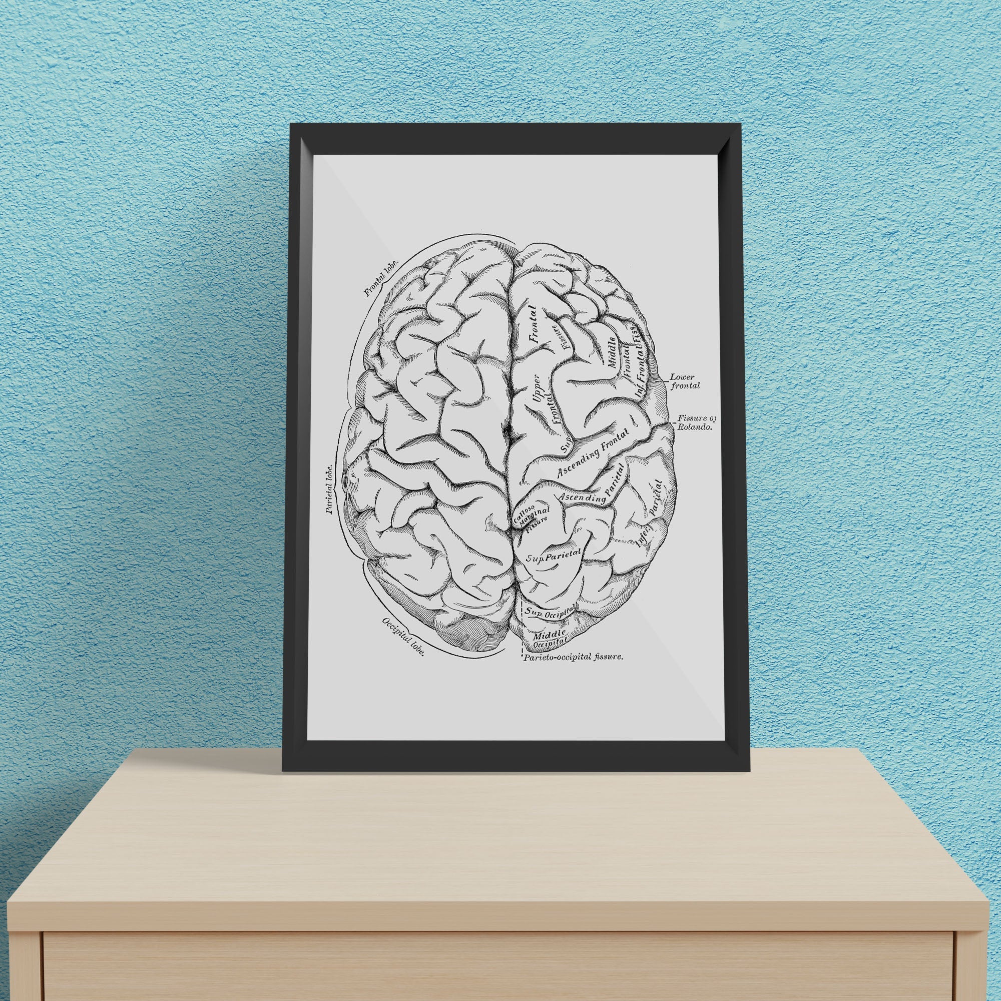 Antique Human Brain 2 - Framed Poster For Clinics, Hospitals &amp; Study Rooms