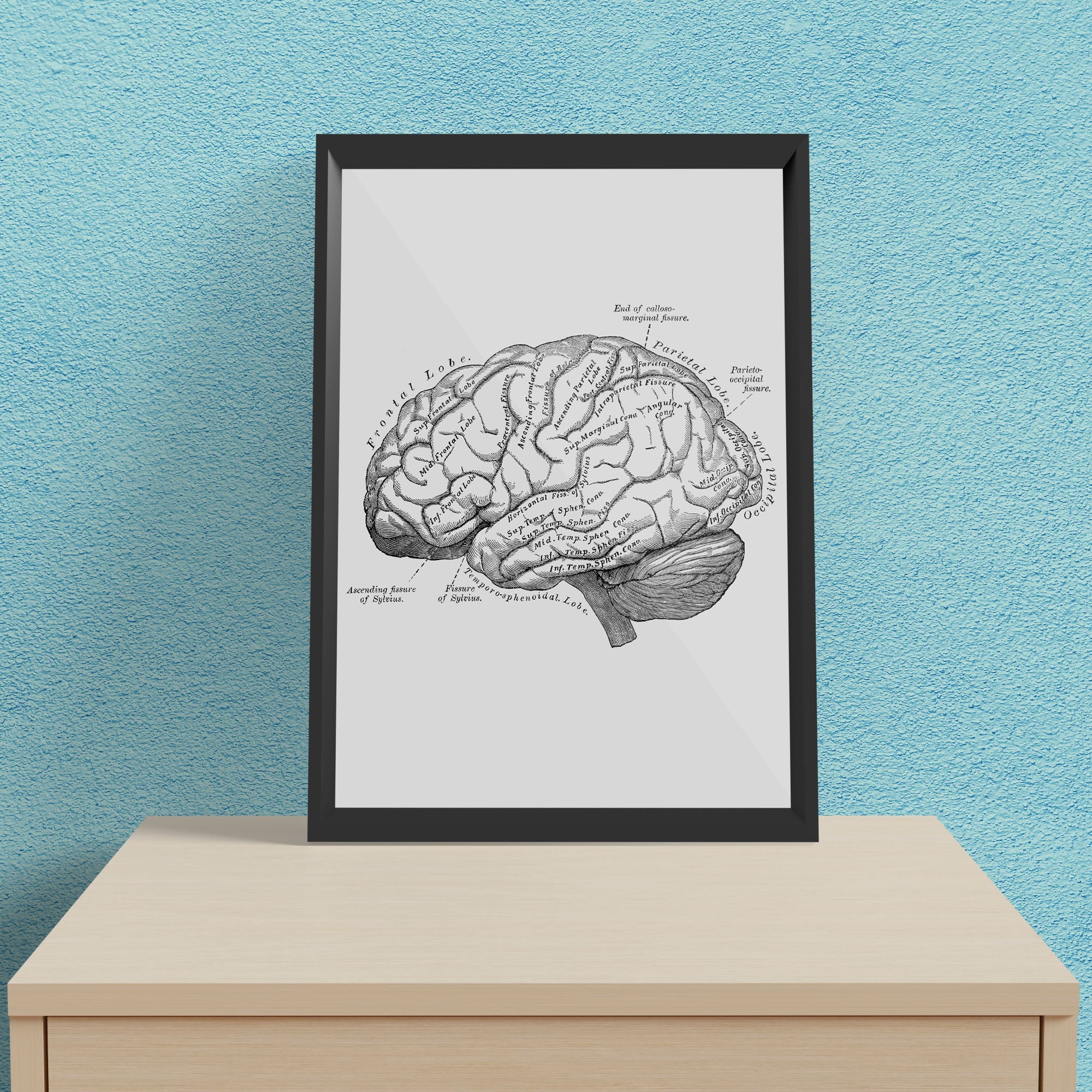 Antique Human Brain 3 - Framed Poster For Clinics, Hospitals &amp; Study Rooms