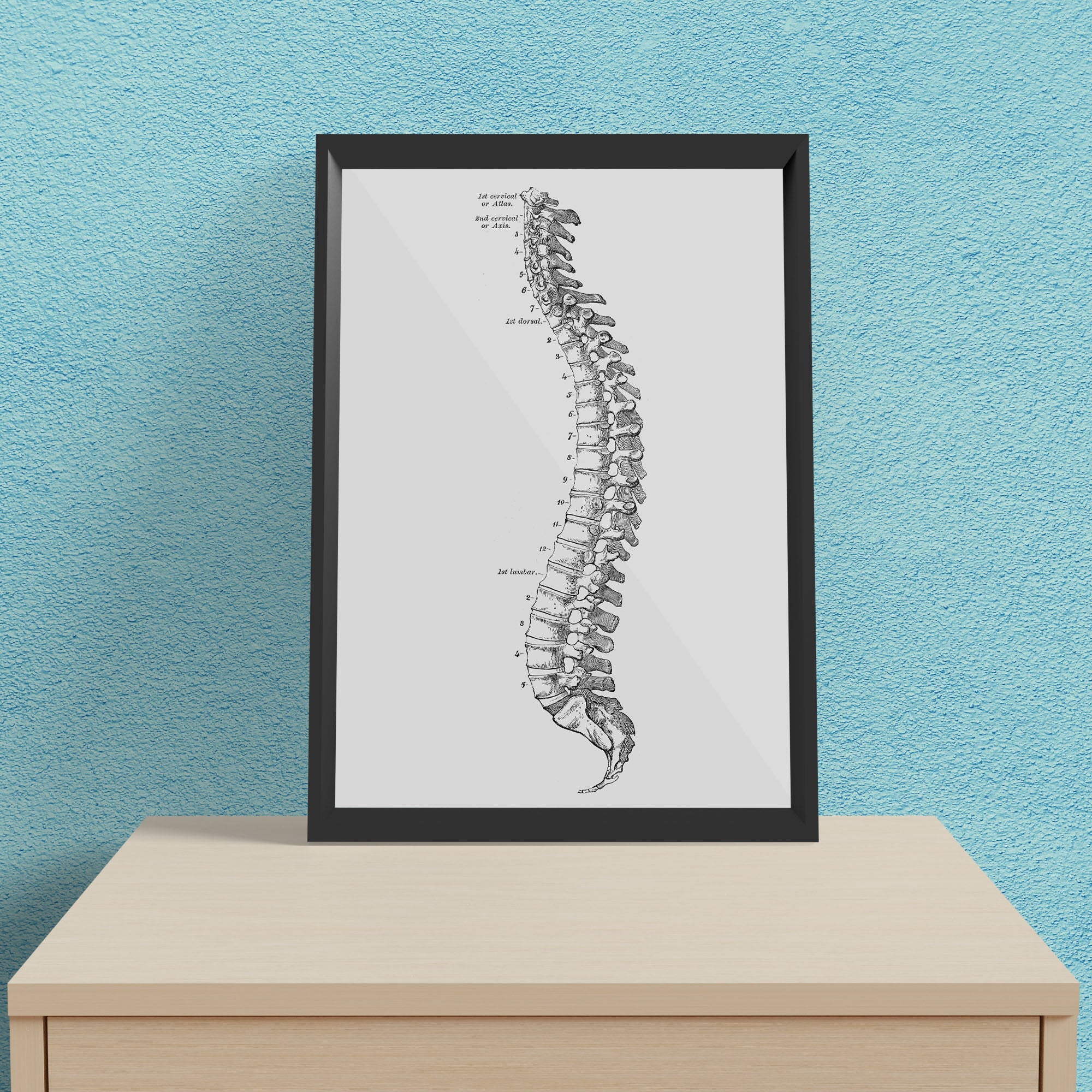 Spine Anatomy - Framed Poster For Clinics, Hospitals &amp; Study Rooms